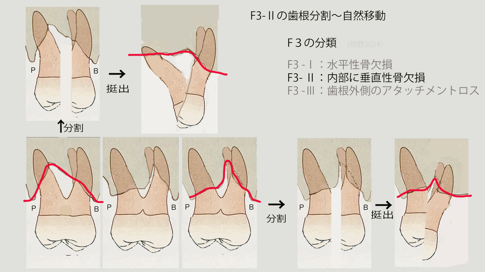 https://www.makino418.com/blog/2024/08/25/F3-2%E5%88%86%E5%89%B2%E3%80%9C%E8%87%AA%E7%84%B6%E7%A7%BB%E5%8B%95.jpg