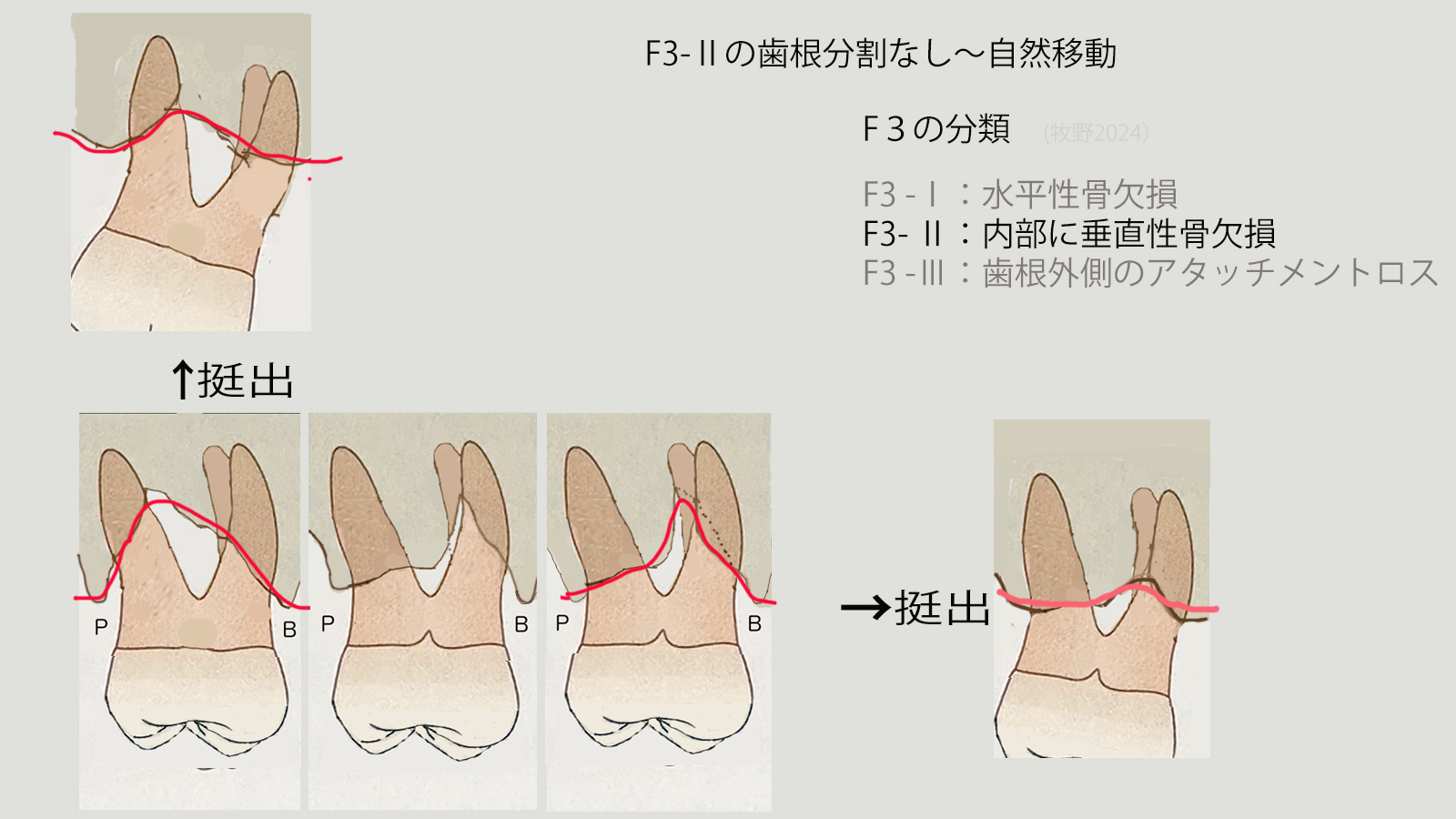 https://www.makino418.com/blog/2024/08/25/F3-2%E5%88%86%E5%89%B2%E3%81%AA%E3%81%97%E3%80%9C%E8%87%AA%E7%84%B6%E7%A7%BB%E5%8B%95.jpg