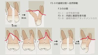 F3-2分割〜自然移動.jpg