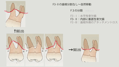 F3-2分割なし〜自然移動.jpg