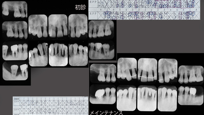 初診〜メンテX-P.jpg